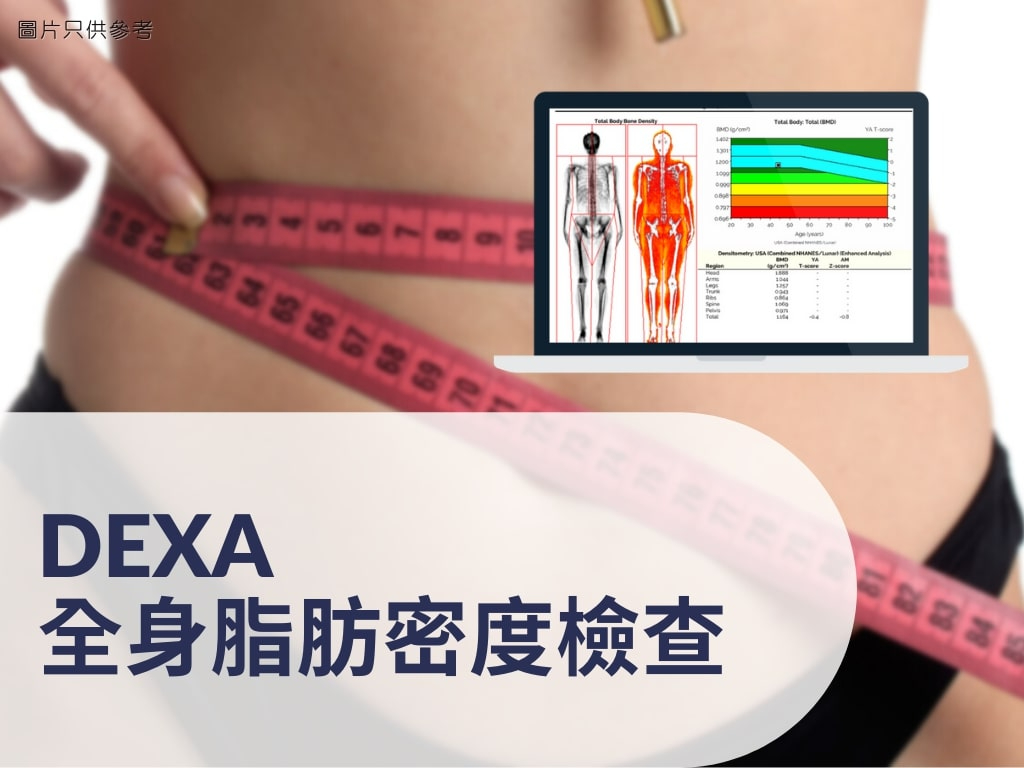 DEXA – 全身脂肪密度檢查 (Wholebody Composition Analysis)（1次）